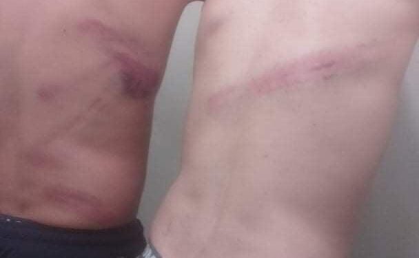 Δράμα: Άγρια βασανιστήρια μεταναστών από αστυνομικούς – Έρευνα διέταξε η ΕΛΑΣ