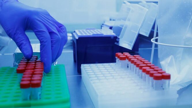 Ιατρικός Σύλλογος Καβάλας: Στο πλευρό των ιδιωτών εργαστηριακών συναδέλφων