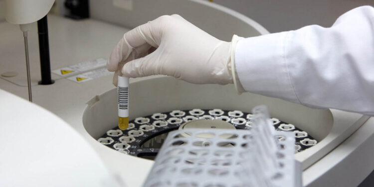 Οι Ιατρικοί Σύλλογοι της ΑΜ-Θ στηρίζουν τον αγώνα των εργαστηριακών συναδέλφων τους